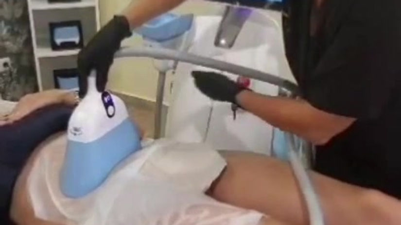 Cryo-Sculpt - The Latest Technology in Fat Freezing!